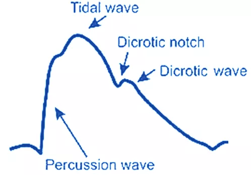 Arterial pulse jpg Arterial and Venous Pulse (JVP) Focused Notes