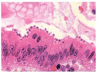 Cryptosporidium Image based MCQ - NEET PG Past Papers - PART 15 NEET PG Exams