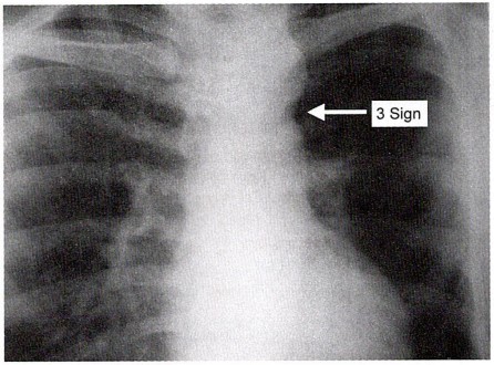 aorta Image based MCQ - NEET PG Past Papers - PART 15 NEET PG Exams